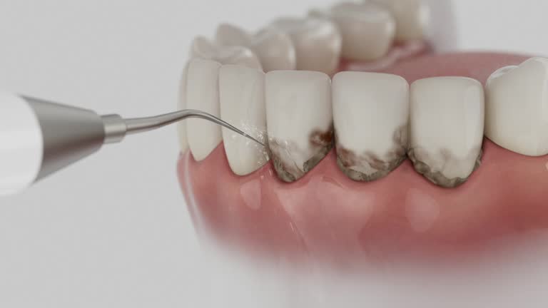 Trusted Invisalign Clear Aligners service in Manchester, KY - Dentist Open Now